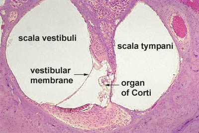 cochlear histology labeled Ear Histology - Cochlea (labels) - histology slide - cochlear histology labeled Ear Histology - Cochlea (labels) - histology slide -