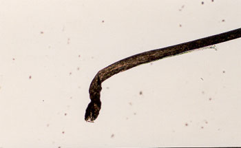 Hair Histology Hair Anagen Hair Root