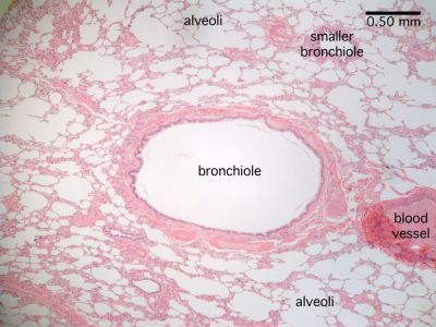 bronchioles histology