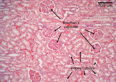 labeled kidney slide