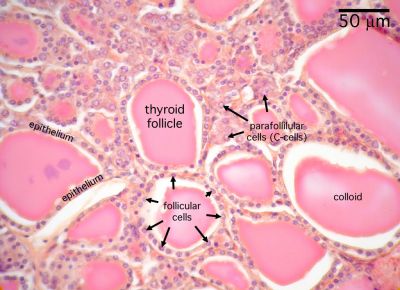normal thyroid histology