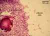 Filename=agedthymus40X_lbl.jpg
Filesize=275KiB
Dimensions=1024x735
Date added=May 16, 2009 agedthymus40X_lbl.jpg