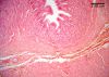 Filename=mucosa10Xcardiac.jpg
Filesize=439KiB
Dimensions=1024x737
Date added=Feb 18, 2009 mucosa10Xcardiac.jpg