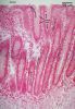 Filename=mucosa40Xcolon_lbl.jpg
Filesize=631KiB
Dimensions=1024x1481
Date added=Feb 18, 2009 mucosa40Xcolon_lbl.jpg