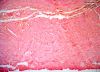 Filename=muscularis10Xcardiac.jpg
Filesize=502KiB
Dimensions=1024x745
Date added=Feb 18, 2009 muscularis10Xcardiac.jpg