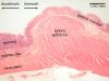 Filename=sphincter_lbl.jpg
Filesize=397KiB
Dimensions=1024x768
Date added=Feb 18, 2009 sphincter_lbl.jpg