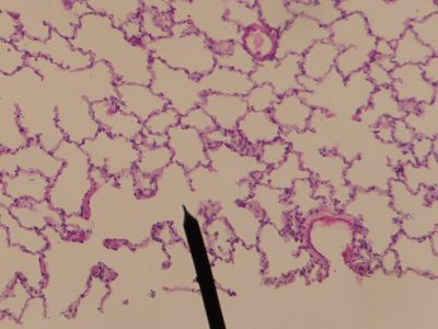 Lung - histology slide
This is a histology slide of the lung.

Image by Jpogi, via Wikimedia Commons. Public domain.

No changes were made to the original image downloaded (note: this version was downloaded at reduced resolution from Wikimedia Commons).

