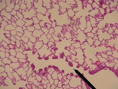 Lung - histology slide
Image by Jpogi at Wikipedia, via Wikimedia Commons. 

No changes were made to the original image downloaded (note: this version was downloaded at reduced resolution from Wikimedia Commons).

