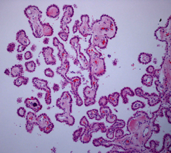 Choroid plexus - histology slide
Image by [url=https://commons.wikimedia.org/wiki/User:Marvin_101]Marvin_101[/url], via Wikimedia Commons. Source=Photographed by Martin Hasselblatt MD 

Original file source: [url=https://commons.wikimedia.org/wiki/File:Choroid_Plexus_Histology_40x.png]https://commons.wikimedia.org/wiki/File:Choroid_Plexus_Histology_40x.png [/url]

Title: "Choroid Plexus Histology 40x.png"

No changes were made to the original image downloaded.  

This file is licensed under the Creative Commons Attribution-Share Alike 3.0 Unported license. [url=https://creativecommons.org/licenses/by-sa/3.0/deed.en]https://creativecommons.org/licenses/by-sa/3.0/deed.en[/url]

