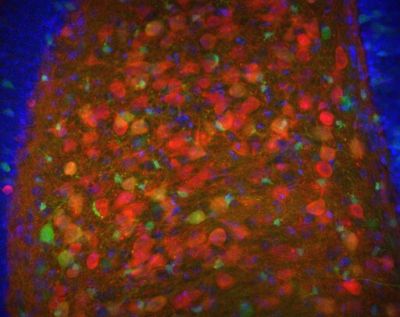 Dentate gyrus of hippocampal formation – histology slide
Cells in the hilus of the dentate gyrus of the hippocampal formation from an Nr4a1-eGFP (green) transgenic mouse stained for calretinin (red) and DAPI (blue) to show nuclei. 

Creator: Margaret I. Davis 

Photo Source: National Institutes of Health (NIH), via Wikimedia Commons

Usage: No changes were made from the download from Wikimedia Commons.  

File URL: 
https://commons.wikimedia.org/wiki/File%3ADentate_gyrus.jpg?utm_source=chatgpt.com

Keywords: rodent