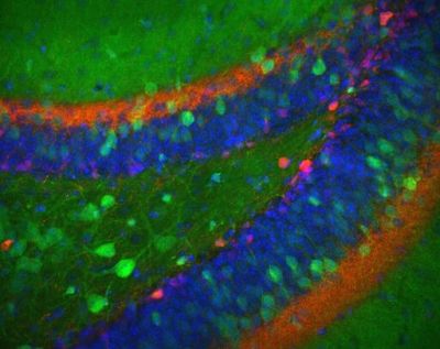 Dentate gyrus of hippocampal formation – histology slide
The hilus of the dentate gyrus from an Nr4a1-eGFP (green) transgenic mouse stained for calretinin (red) and DAPI (blue) to show nuclei. 

Creator: Margaret I. Davis 

Photo Source: National Institutes of Health (NIH), via Wikimedia Commons

Usage: No changes were made from the download from Wikimedia Commons.  

File URL:
https://commons.wikimedia.org/wiki/File:Dentate_gyrus_II.jpg


Keywords: rodent