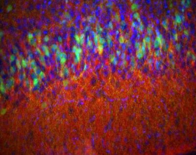 Piriform cortex, mouse -  histology slide 
Piriform cortex from a 14 day old D2-eGFP (green) mouse stained for enkephalin (red) and DAPI (blue) to show nuclei. Epifluorescence.

Creator: Margaret I. Davis 

Photo Source: National Institutes of Health (NIH), via Wikimedia Commons

Usage: No changes were made from the download from Wikimedia Commons.  

File URL: https://commons.wikimedia.org/wiki/File:Piriform_cortex_of_a_mouse.jpg


Keywords: rodent