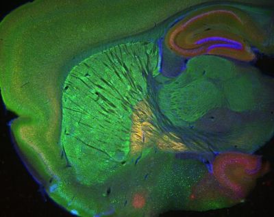 Sagittal mouse cannabinoid receptor nuclei – histology slide
Sagittal section of an Nr4a1-eGFP transgenic mouse stained for the CB1 cannabinoid receptor and DAPI to show nuclei. Image was taken with a Zeiss Lumar stereomicroscope.

Creator: Margaret I. Davis 

Photo Source: National Institutes of Health (NIH), via Wikimedia Commons

Usage: No changes were made from the download from Wikimedia Commons.  

File URL: https://commons.wikimedia.org/wiki/File:Sagittal_mouse_cannabinoid_receptor_nuclei.jpg


Keywords: rodent