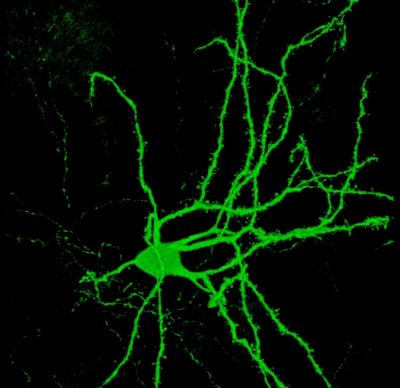 Neuron - confocal image
Confocal image of an eGFP filled striatal medium spiny neuron. The projection image was pseudocolored with the ramp look up table using NIH Image J. Does not include psuedocoloring.

Creator: Margaret I. Davis 

Photo Source: National Institutes of Health (NIH), via Wikimedia Commons

Usage: No changes were made from the download from Wikimedia Commons.  

File URL: https://commons.wikimedia.org/wiki/File:Confocal_image_of_spiny_neuron_-_1.jpg


