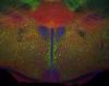 512px-Hypothalamus_calretinin_nuclei.jpg