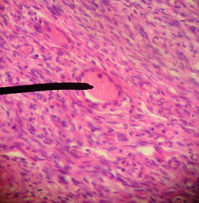 Ovary - histology slide
This is a histology slide of the ovary

Original image by Jpogi at English Wikipedia, via Wikimedia Commons. Public domain.

Changes were made to the original image.

