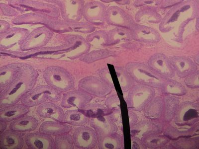 Testes - histology slide
This is a histology slide of the testis. The pointer is on the mediastinum testis.

Image by Jpogi at Wikipedia, via Wikimedia Commons. Public domain.

No changes were made to the original image downloaded (note: this version was downloaded at reduced resolution from Wikimedia Commons).

