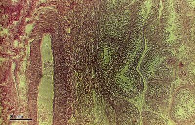 Testes - histology slide 
Testicles. Optical microscopy technique: Positive phase contrast. Magnification: 300x (for picture width 26 cm ~ A4 format). (Description text from the Wikimedia Commons file page.)

Image by [url=https://cs.wikipedia.org/wiki/Josef_Reischig]Josef Reischig[/url], via Wikimedia Commons. 

Source: Author's archive
Original file source: [url=https://commons.wikimedia.org/wiki/File:Testicles_(254_18).jpg]https://commons.wikimedia.org/wiki/File:Testicles_(254_18).jpg[/url]

Title: "Testicles_(254_18).jpg"

No changes were made to the original image downloaded (note: this version was downloaded at reduced resolution from Wikimedia Commons).

The heirs of the creator of this work hereby publish it under the following license:
This file is licensed under the Creative Commons Attribution-Share Alike 3.0 Unported License [url=https://creativecommons.org/licenses/by-sa/3.0/deed.en/]https://creativecommons.org/licenses/by-sa/3.0/deed.en/[/url]

