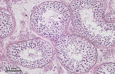 Testes - histology slide 
Testicles: Cross-section. Stain: Hematoxylin and eosin. Optical microscopy technique: Bright field. Magnification: 360x (for picture width 26 cm ~ A4 format). (Description text from the Wikimedia Commons file page.)

Image by [url=https://cs.wikipedia.org/wiki/Josef_Reischig]Josef Reischig[/url], via Wikimedia Commons. 

Original file source: [url=https://commons.wikimedia.org/wiki/File:Testicles_%2826_2_11%29_Cross-section.jpg]https://commons.wikimedia.org/wiki/File:Testicles_%2826_2_11%29_Cross-section.jpg[/url]

Title: "Testicles (26 2 11) Cross-section.jpg"

No changes were made to the original image downloaded (note: this version was downloaded at reduced resolution from Wikimedia Commons).

This file is licensed under the Creative Commons Attribution-Share Alike 3.0 Unported License [url=https://creativecommons.org/licenses/by-sa/3.0/deed.en/]https://creativecommons.org/licenses/by-sa/3.0/deed.en/[/url]

