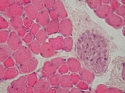 Skeletal muscle, cross section - histology slide
Image by Department of Histology, Jagiellonian University Medical College ([url=http://histologia.cm-uj.krakow.pl/index.html]1[/url]; [url=https://web.archive.org/web/20060216212659/http://www.histologia.cm-uj.krakow.pl/index.html]archive copy[/url] at the Wayback Machine), via Wikimedia Commons.

Original file source: [url=https://commons.wikimedia.org/wiki/File:Skeletal_muscle_-_cross_section,_nerve_bundle.jpg]https://commons.wikimedia.org/wiki/File:Skeletal_muscle_-_cross_section,_nerve_bundle.jpg[/url]

Title: "Skeletal muscle - cross section, nerve bundle.jpg"

No changes were made to the original image downloaded. 

Permission is granted to copy, distribute and/or modify this document under the terms of the GNU Free Documentation License, Version 1.2 or any later version published by the Free Software Foundation; with no Invariant Sections, no Front-Cover Texts, and no Back-Cover Texts. A copy of the license is included in the section entitled GNU Free Documentation License. [url=https://commons.wikimedia.org/wiki/Commons:GNU_Free_Documentation_License,_version_1.2]https://commons.wikimedia.org/wiki/Commons:GNU_Free_Documentation_License,_version_1.2[/url]

This file is licensed under the Creative Commons Attribution-Share Alike 3.0 Unported License [url=https://creativecommons.org/licenses/by-sa/3.0/deed.en/]https://creativecommons.org/licenses/by-sa/3.0/deed.en/[/url]
