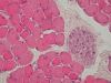 Filename=Skeletal_muscle_-_cross_section2C_nerve_bundle.jpg
Filesize=65KiB
Dimensions=709x532
Date added=Oct 27, 2025 Skeletal_muscle_-_cross_section2C_nerve_bundle.jpg