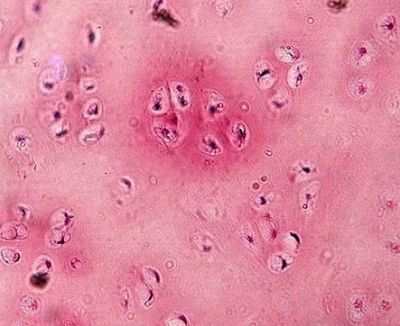 Hyaline cartilage - histology slide
Image by Department of Histology, Jagiellonian University Medical College ([url=http://histologia.cm-uj.krakow.pl/index.html]1[/url]; [url=https://web.archive.org/web/20060216212659/http://www.histologia.cm-uj.krakow.pl/index.html]archive copy[/url] at the Wayback Machine), via Wikimedia Commons.

Original file source: [url=https://commons.wikimedia.org/wiki/File:Hyaline_cartilage.jpg] https://commons.wikimedia.org/wiki/File:Hyaline_cartilage.jpg[/url]

Title: "Hyaline cartilage.jpg"

No changes were made to the original image downloaded. 

Permission is granted to copy, distribute and/or modify this document under the terms of the GNU Free Documentation License, Version 1.2 or any later version published by the Free Software Foundation; with no Invariant Sections, no Front-Cover Texts, and no Back-Cover Texts. A copy of the license is included in the section entitled GNU Free Documentation License. [url=https://commons.wikimedia.org/wiki/Commons:GNU_Free_Documentation_License,_version_1.2]https://commons.wikimedia.org/wiki/Commons:GNU_Free_Documentation_License,_version_1.2[/url]

This file is licensed under the Creative Commons Attribution-Share Alike 3.0 Unported License [url=https://creativecommons.org/licenses/by-sa/3.0/deed.en/]https://creativecommons.org/licenses/by-sa/3.0/deed.en/[/url]

