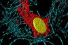 Filename=512px-Fibroblast_28BPAE29.jpg
Filesize=95KiB
Dimensions=512x341
Date added=Oct 03, 2025 512px-Fibroblast_28BPAE29.jpg