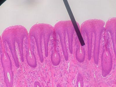 Tongue - histology slide
This is histology slide of a human tongue showing papillae.

Image by Jpogi at Wikipedia, via Wikimedia Commons. Public domain.

No changes were made to the original image downloaded (note: this version was downloaded at reduced resolution from Wikimedia Commons).

