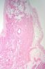 500px-Sinoatrial_node_low_mag.jpg