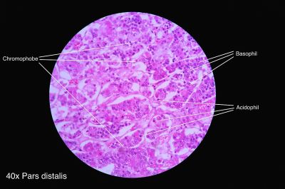 Pituitary gland - pars distalis (labels) - histology slide
This is a histology slide of the pars distalis of the pituitary gland.

Histology slide courtesy of Athikhun.suw and Wikimedia Commons. No changes were made from the download. 

This file is licensed under the  Creative Commons Attribution-Share Alike 4.0 International license (https://creativecommons.org/licenses/by-sa/4.0/deed.en) 

