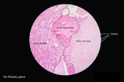 Pituitary gland (labels) - histology slide
This is a histology slide of the pituitary gland.

Histology slide courtesy of Athikhun.suw and Wikimedia Commons. No changes were made from the download. 

This file is licensed under the  Creative Commons Attribution-Share Alike 4.0 International license (https://creativecommons.org/licenses/by-sa/4.0/deed.en) 

