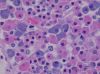 Histology_of_pars_distalis_of_the_anterior_pituitary_with_chromophobes2C_basophils2C_and_acidophils.jpg