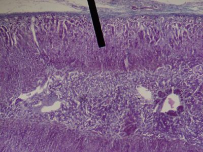 Adrenal gland - histology slide
This is a histology slide of the adrenal gland. The pointer is on the zona fasiculata of the adrenal cortex.

Image by Jpogi, via Wikimedia Commons. Public domain.

No changes were made to the original image downloaded (note: this version was downloaded at reduced resolution from Wikimedia Commons).


