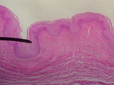 Vaginal tissue - histology slide
This is a histology slide of vaginal tissue.

Image by Jpogi at English Wikipedia, via Wikimedia Commons. Public domain.

No changes were made to the original image downloaded (note: this version was downloaded at reduced resolution from Wikimedia Commons).

