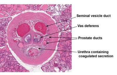 Prostate, rodent (labels) - histology slide
Histology image of rodent prostate.

Image courtesy of National Toxicology Program; US Department of Health and Human Services.
Keywords: prostate