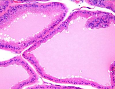 Prostate, rodent - histology slide
Histology image of rodent prostate.

Image courtesy of National Toxicology Program; US Department of Health and Human Services.
Keywords: prostate