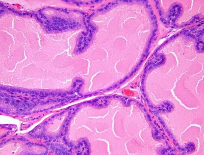 Prostate, rodent - histology slide
Histology image of rodent prostate.

Image courtesy of National Toxicology Program; US Department of Health and Human Services.
Keywords: prostate