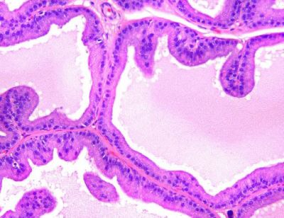 Prostate, rodent - histology slide
Histology image of rodent prostate.

Image courtesy of National Toxicology Program; US Department of Health and Human Services.
Keywords: prostate