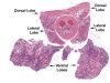 prostate1.JPG