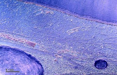 Tooth - histology slide 
Tooth: Histologic section of tooth. Optical microscopy technique: Differential interference contrast (Nomarski). Magnification: 300x (for picture width 26 cm ~ A4 format). (Description text from the Wikimedia Commons file page.)

Image by [url=https://cs.wikipedia.org/wiki/Josef_Reischig]Josef Reischig[/url], via Wikimedia Commons. 

Source: Author's archive

Original file source: [url=https://commons.wikimedia.org/wiki/File:Tooth_%28248_15%29_Histologic_section_of_tooth.jpg]https://commons.wikimedia.org/wiki/File:Tooth_%28248_15%29_Histologic_section_of_tooth.jpg[/url]

Title: "Tooth_(248_15)_Histologic_section_of_tooth.jpg"

No changes were made to the original image downloaded (note: this version was downloaded at reduced resolution from Wikimedia Commons).

The heirs of the creator of this work hereby publish it under the following license:
This file is licensed under the Creative Commons Attribution-Share Alike 3.0 Unported license [url=https://creativecommons.org/licenses/by-sa/3.0/deed.en/]https://creativecommons.org/licenses/by-sa/3.0/deed.en/[/url]

