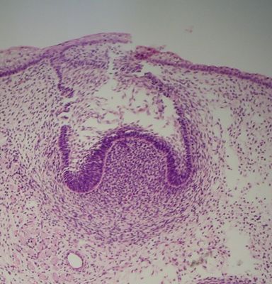 Developing tooth – histology slide
Histology of developing tooth with no labels. Tooth is in cap stage. (Description text from the Wikimedia Commons file page.)

Image by [url=https://commons.wikimedia.org/wiki/User:Dozenist]Dozenist[/url], via Wikimedia Commons. 

Original file source: [url=https://commons.wikimedia.org/wiki/File:Capstage11-23-05.jpg]https://commons.wikimedia.org/wiki/File:Capstage11-23-05.jpg[/url]

Title: "Capstage11-23-05.jpg"

No changes were made to the original image downloaded.  

Permission is granted to copy, distribute and/or modify this document under the terms of the GNU Free Documentation License, Version 1.2 or any later version published by the Free Software Foundation; with no Invariant Sections, no Front-Cover Texts, and no Back-Cover Texts. A copy of the license is included in the section entitled GNU Free Documentation License. [url=https://commons.wikimedia.org/wiki/Commons:GNU_Free_Documentation_License,_version_1.2]https://commons.wikimedia.org/wiki/Commons:GNU_Free_Documentation_License,_version_1.2[/url]

This file is licensed under the Creative Commons Attribution-ShareAlike 3.0 Unported license. [url=https://creativecommons.org/licenses/by-sa/3.0/deed.en]https://creativecommons.org/licenses/by-sa/3.0/deed.en[/url]

This file is licensed under the Creative Commons Attribution-ShareAlike [url=https://creativecommons.org/licenses/by-sa/2.5/deed.en]2.5 Generic[/url], [url=https://creativecommons.org/licenses/by-sa/2.0/deed.en]2.0 Generic[/url] and [url=https://creativecommons.org/licenses/by-sa/1.0/deed.en]1.0 Generic[/url] license.


