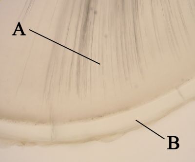 Tooth (labels) – histology slide
Histologic slide of cross-section of tooth at root with dentin labeled A and cementum labeled B.  (Description text from the Wikimedia Commons file page.)

Image by [url=https://commons.wikimedia.org/wiki/User:Dozenist]Dozenist[/url], via Wikimedia Commons. 

Original file source: [url=https://commons.wikimedia.org/wiki/File:Crosssectionroottooth11-24-05.jpg] https://commons.wikimedia.org/wiki/File:Crosssectionroottooth11-24-05.jpg [/url]

Title: "Crosssectionroottooth11-24-05.jpg "

No changes were made to the original image downloaded.  

Permission is granted to copy, distribute and/or modify this document under the terms of the GNU Free Documentation License, Version 1.2 or any later version published by the Free Software Foundation; with no Invariant Sections, no Front-Cover Texts, and no Back-Cover Texts. A copy of the license is included in the section entitled GNU Free Documentation License. [url=https://commons.wikimedia.org/wiki/Commons:GNU_Free_Documentation_License,_version_1.2]https://commons.wikimedia.org/wiki/Commons:GNU_Free_Documentation_License,_version_1.2[/url]

This file is licensed under the Creative Commons Attribution-ShareAlike 3.0 Unported license.  
[url=https://creativecommons.org/licenses/by-sa/3.0/deed.en]https://creativecommons.org/licenses/by-sa/3.0/deed.en[/url]

This file is licensed under the Creative Commons Attribution-ShareAlike [url=https://creativecommons.org/licenses/by-sa/2.5/deed.en]2.5 Generic[/url], [url=https://creativecommons.org/licenses/by-sa/2.0/deed.en]2.0 Generic[/url] and [url=https://creativecommons.org/licenses/by-sa/1.0/deed.en]1.0 Generic[/url] license.


