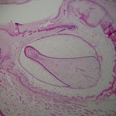 Developing tooth – histology slide
Histology of developing tooth with no labels. Tooth is in maturation/crown stage. (Description text from the Wikimedia Commons file page.)

Image by [url=https://commons.wikimedia.org/wiki/User:Dozenist]Dozenist[/url], via Wikimedia Commons. 

Original file source: [url=https://commons.wikimedia.org/wiki/File:Crownstage11-18-05.jpg]https://commons.wikimedia.org/wiki/File:Crownstage11-18-05.jpg[/url]

Title: "Crownstage11-18-05.jpg"

No changes were made to the original image downloaded.  

Permission is granted to copy, distribute and/or modify this document under the terms of the GNU Free Documentation License, Version 1.2 or any later version published by the Free Software Foundation; with no Invariant Sections, no Front-Cover Texts, and no Back-Cover Texts. A copy of the license is included in the section entitled GNU Free Documentation License. [url=https://commons.wikimedia.org/wiki/Commons:GNU_Free_Documentation_License,_version_1.2]https://commons.wikimedia.org/wiki/Commons:GNU_Free_Documentation_License,_version_1.2[/url]

This file is licensed under the Creative Commons Attribution-ShareAlike 3.0 Unported license. [url=https://creativecommons.org/licenses/by-sa/3.0/deed.en]https://creativecommons.org/licenses/by-sa/3.0/deed.en[/url]

This file is licensed under the Creative Commons Attribution-ShareAlike [url=https://creativecommons.org/licenses/by-sa/2.5/deed.en]2.5 Generic[/url], [url=https://creativecommons.org/licenses/by-sa/2.0/deed.en]2.0 Generic[/url] and [url=https://creativecommons.org/licenses/by-sa/1.0/deed.en]1.0 Generic[/url] license.

