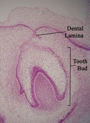 Developing tooth (labels) – histology slide
Histology of developing tooth with dental lamina and tooth bud labeled. (Description text from the Wikimedia Commons file page.)

Image by [url=https://commons.wikimedia.org/wiki/User:Dozenist]Dozenist[/url], via Wikimedia Commons. 

Original file source: [url=https://commons.wikimedia.org/wiki/File:Dentallamina11-17-05.jpg]https://commons.wikimedia.org/wiki/File:Dentallamina11-17-05.jpg[/url]

Title: "Dentallamina11-17-05.jpg"

No changes were made to the original image downloaded.  

Permission is granted to copy, distribute and/or modify this document under the terms of the GNU Free Documentation License, Version 1.2 or any later version published by the Free Software Foundation; with no Invariant Sections, no Front-Cover Texts, and no Back-Cover Texts. A copy of the license is included in the section entitled GNU Free Documentation License. [url=https://commons.wikimedia.org/wiki/Commons:GNU_Free_Documentation_License,_version_1.2]https://commons.wikimedia.org/wiki/Commons:GNU_Free_Documentation_License,_version_1.2[/url]

This file is licensed under the Creative Commons Attribution-ShareAlike 3.0 Unported license. [url=https://creativecommons.org/licenses/by-sa/3.0/deed.en]https://creativecommons.org/licenses/by-sa/3.0/deed.en[/url]

This file is licensed under the Creative Commons Attribution-ShareAlike [url=https://creativecommons.org/licenses/by-sa/2.5/deed.en]2.5 Generic[/url], [url=https://creativecommons.org/licenses/by-sa/2.0/deed.en]2.0 Generic[/url] and [url=https://creativecommons.org/licenses/by-sa/1.0/deed.en]1.0 Generic[/url] license.

