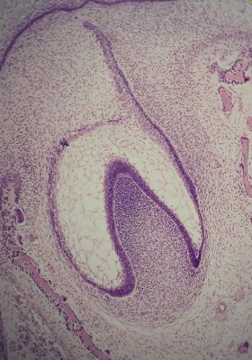 Developing tooth – histology slide
Histology of developing tooth with no labels. Tooth bud is in early bell stage. (Description text from the Wikimedia Commons file page.)

Image by [url=https://commons.wikimedia.org/wiki/User:Dozenist]Dozenist[/url], via Wikimedia Commons. 

Original file source: [url=https://commons.wikimedia.org/wiki/File:Earlybellstage11-18-05.jpg]https://commons.wikimedia.org/wiki/File:Earlybellstage11-18-05.jpg[/url]

Title: "Earlybellstage11-18-05.jpg"

No changes were made to the original image downloaded.  

Permission is granted to copy, distribute and/or modify this document under the terms of the GNU Free Documentation License, Version 1.2 or any later version published by the Free Software Foundation; with no Invariant Sections, no Front-Cover Texts, and no Back-Cover Texts. A copy of the license is included in the section entitled GNU Free Documentation License. [url=https://commons.wikimedia.org/wiki/Commons:GNU_Free_Documentation_License,_version_1.2]https://commons.wikimedia.org/wiki/Commons:GNU_Free_Documentation_License,_version_1.2[/url]

This file is licensed under the Creative Commons Attribution-ShareAlike 3.0 Unported license. [url=https://creativecommons.org/licenses/by-sa/3.0/deed.en]https://creativecommons.org/licenses/by-sa/3.0/deed.en[/url]

This file is licensed under the Creative Commons Attribution-ShareAlike [url=https://creativecommons.org/licenses/by-sa/2.5/deed.en]2.5 Generic[/url], [url=https://creativecommons.org/licenses/by-sa/2.0/deed.en]2.0 Generic[/url] and [url=https://creativecommons.org/licenses/by-sa/1.0/deed.en]1.0 Generic[/url] license.


