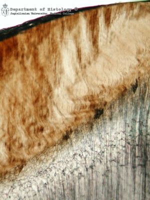 Tooth (enamel and dentine, ground section) - histology slide
A cross-section through enamel (up) and dentine (down). Courtesy Department of Histology, Jagiellonian University Medical College in Cracow ([url=http://histologia.cm-uj.krakow.pl/index.html]1[/url])
(Description text from the Wikimedia Commons file page.)

Source: Department of Histology CMUJ Cracow [url=http://www.histologia.cm-uj.krakow.pl/Repetytorium/Zab/zab_1.html]3[/url]

Author: [url=https://commons.wikimedia.org/wiki/User:Reytan]Reytan[/url], via Wikimedia Commons.

Original file source: [url=https://commons.wikimedia.org/wiki/File:Enamel_and_dentine_-_ground_section.jpg]https://commons.wikimedia.org/wiki/File:Enamel_and_dentine_-_ground_section.jpg[/url]

Title: "Enamel and dentine - ground section.jpg"

No changes were made to the original image downloaded. 

Permission is granted to copy, distribute and/or modify this document under the terms of the GNU Free Documentation License, Version 1.2 or any later version published by the Free Software Foundation; with no Invariant Sections, no Front-Cover Texts, and no Back-Cover Texts. A copy of the license is included in the section entitled GNU Free Documentation License. [url=https://commons.wikimedia.org/wiki/Commons:GNU_Free_Documentation_License,_version_1.2]https://commons.wikimedia.org/wiki/Commons:GNU_Free_Documentation_License,_version_1.2[/url]

This file is licensed under the Creative Commons Attribution-Share Alike 3.0 Unported License [url=https://creativecommons.org/licenses/by-sa/3.0/deed.en/]https://creativecommons.org/licenses/by-sa/3.0/deed.en/[/url]

