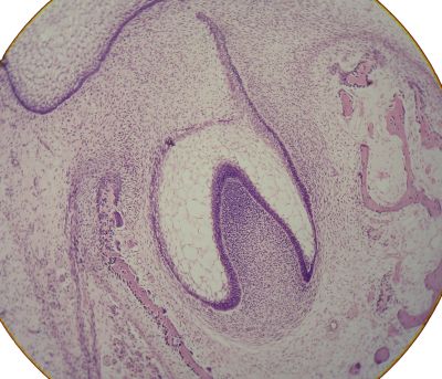 Tooth bud – histology slide
Histologic picture taken of tooth bud with no labels. (Description text from the Wikimedia Commons file page.)

Image by [url=https://commons.wikimedia.org/wiki/User:Dozenist]Dozenist[/url], via Wikimedia Commons. 

Original file source: [url=https://commons.wikimedia.org/wiki/File:Toothbud11-19-05.jpg]https://commons.wikimedia.org/wiki/File:Toothbud11-19-05.jpg[/url]

Title: "Toothbud11-19-05.jpg"

No changes were made to the original image downloaded.  

Permission is granted to copy, distribute and/or modify this document under the terms of the GNU Free Documentation License, Version 1.2 or any later version published by the Free Software Foundation; with no Invariant Sections, no Front-Cover Texts, and no Back-Cover Texts. A copy of the license is included in the section entitled GNU Free Documentation License. [url=https://commons.wikimedia.org/wiki/Commons:GNU_Free_Documentation_License,_version_1.2]https://commons.wikimedia.org/wiki/Commons:GNU_Free_Documentation_License,_version_1.2[/url]

This file is licensed under the Creative Commons Attribution-ShareAlike 3.0 Unported license. [url=https://creativecommons.org/licenses/by-sa/3.0/deed.en]https://creativecommons.org/licenses/by-sa/3.0/deed.en[/url]

This file is licensed under the Creative Commons Attribution-ShareAlike [url=https://creativecommons.org/licenses/by-sa/2.5/deed.en]2.5 Generic[/url], [url=https://creativecommons.org/licenses/by-sa/2.0/deed.en]2.0 Generic[/url] and [url=https://creativecommons.org/licenses/by-sa/1.0/deed.en]1.0 Generic[/url] license.


