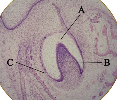Tooth bud (labels) – histology slide
Histologic picture taken of tooth bud with enamel organ, dental papilla, and dental follicle labed by letters A, B, and C.  (Description text from the Wikimedia Commons file page.)

Image by [url=https://commons.wikimedia.org/wiki/User:Dozenist]Dozenist[/url], via Wikimedia Commons. 

Original file source: [url=https://commons.wikimedia.org/wiki/File:Toothbud11-19-05labeled.jpg]https://commons.wikimedia.org/wiki/File:Toothbud11-19-05labeled.jpg[/url]

Title: "Toothbud11-19-05labeled.jpg"

No changes were made to the original image downloaded.  

Permission is granted to copy, distribute and/or modify this document under the terms of the GNU Free Documentation License, Version 1.2 or any later version published by the Free Software Foundation; with no Invariant Sections, no Front-Cover Texts, and no Back-Cover Texts. A copy of the license is included in the section entitled GNU Free Documentation License. [url=https://commons.wikimedia.org/wiki/Commons:GNU_Free_Documentation_License,_version_1.2]https://commons.wikimedia.org/wiki/Commons:GNU_Free_Documentation_License,_version_1.2[/url]

This file is licensed under the Creative Commons Attribution-ShareAlike 3.0 Unported license. [url=https://creativecommons.org/licenses/by-sa/3.0/deed.en]https://creativecommons.org/licenses/by-sa/3.0/deed.en[/url]

This file is licensed under the Creative Commons Attribution-ShareAlike [url=https://creativecommons.org/licenses/by-sa/2.0/deed.en]2.0 Generic[/url].
