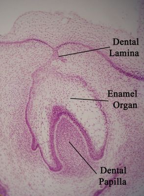 Developing tooth (labels) – histology slide
Histology of developing tooth with enamel organ, dental lamina, and dental papilla labeled. (Description text from the Wikimedia Commons file page.)

Image by [url=https://commons.wikimedia.org/wiki/User:Dozenist]Dozenist[/url], via Wikimedia Commons. 

Original file source: [url=https://commons.wikimedia.org/wiki/File:Toothhistology11-17-05.jpg] https://commons.wikimedia.org/wiki/File:Toothhistology11-17-05.jpg[/url]

Title: "Toothhistology11-17-05.jpg"

No changes were made to the original image downloaded.  

Permission is granted to copy, distribute and/or modify this document under the terms of the GNU Free Documentation License, Version 1.2 or any later version published by the Free Software Foundation; with no Invariant Sections, no Front-Cover Texts, and no Back-Cover Texts. A copy of the license is included in the section entitled GNU Free Documentation License. [url=https://commons.wikimedia.org/wiki/Commons:GNU_Free_Documentation_License,_version_1.2]https://commons.wikimedia.org/wiki/Commons:GNU_Free_Documentation_License,_version_1.2[/url]

This file is licensed under the Creative Commons Attribution-ShareAlike 3.0 Unported license. [url=https://creativecommons.org/licenses/by-sa/3.0/deed.en]https://creativecommons.org/licenses/by-sa/3.0/deed.en[/url]

This file is licensed under the Creative Commons Attribution-ShareAlike [url=https://creativecommons.org/licenses/by-sa/2.5/deed.en]2.5 Generic[/url], [url=https://creativecommons.org/licenses/by-sa/2.0/deed.en]2.0 Generic[/url] and [url=https://creativecommons.org/licenses/by-sa/1.0/deed.en]1.0 Generic[/url] license.


