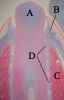 Filename=Eruptingtoothwithlabels11-24-05.jpg
Filesize=278KiB
Dimensions=847x1308
Date added=Oct 17, 2025 Eruptingtoothwithlabels11-24-05.jpg